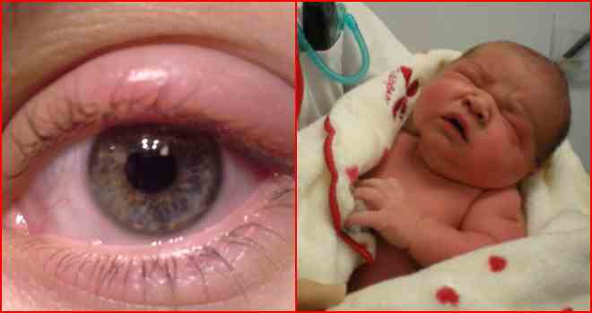 глаз новорожденный