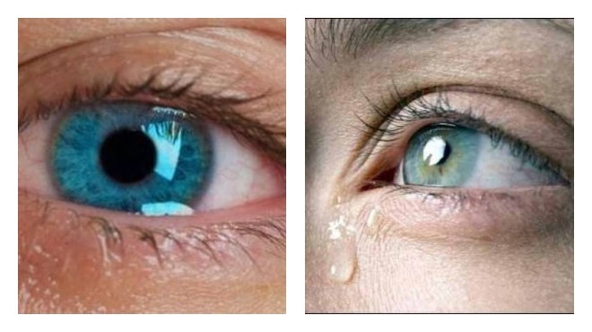 причины слезотечения глаза