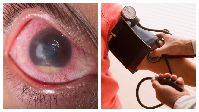 заболевания, взывающие красные точки в глазах