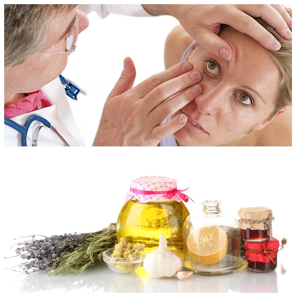 Методы лечения глаукомы народными средствами и предостережения