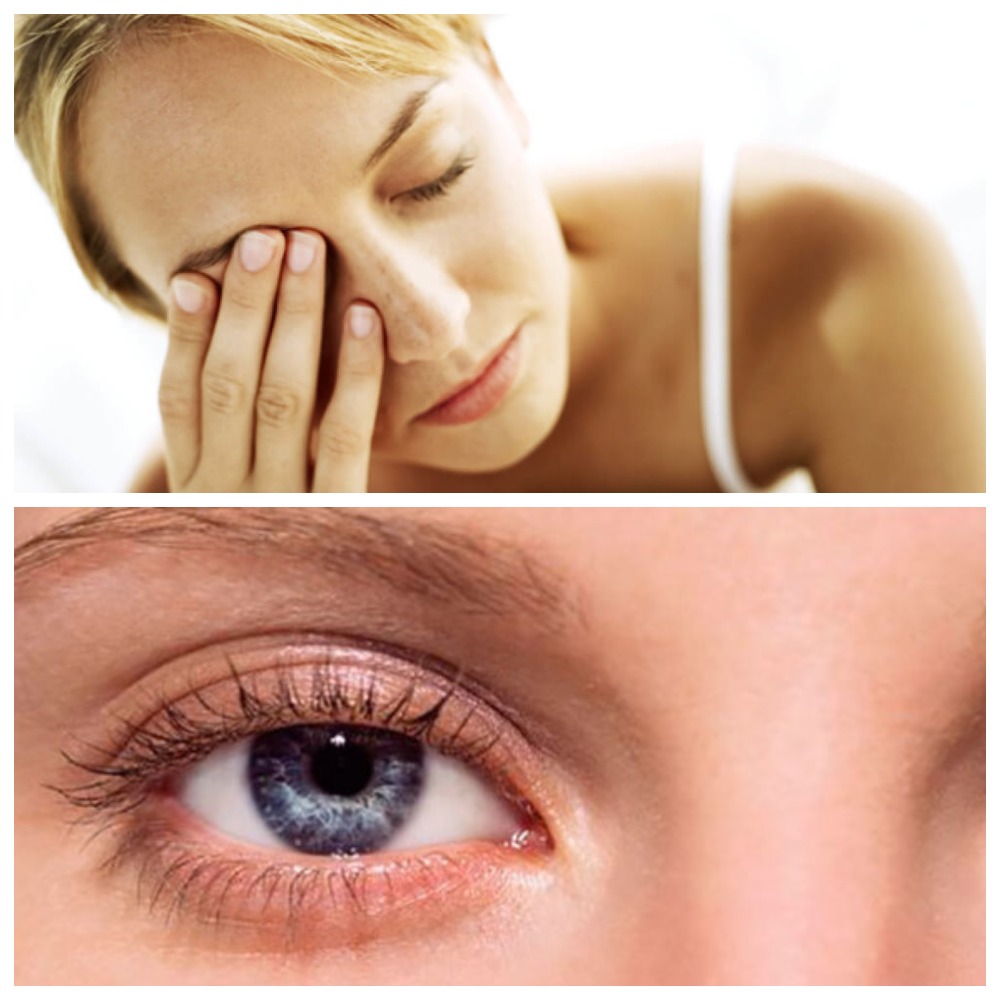 Чем может быть опасна хроническая усталость глаз?