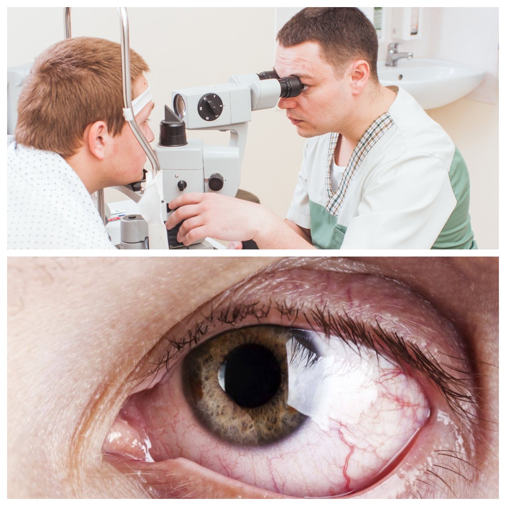 Какие существуют противопоказания при глаукоме
