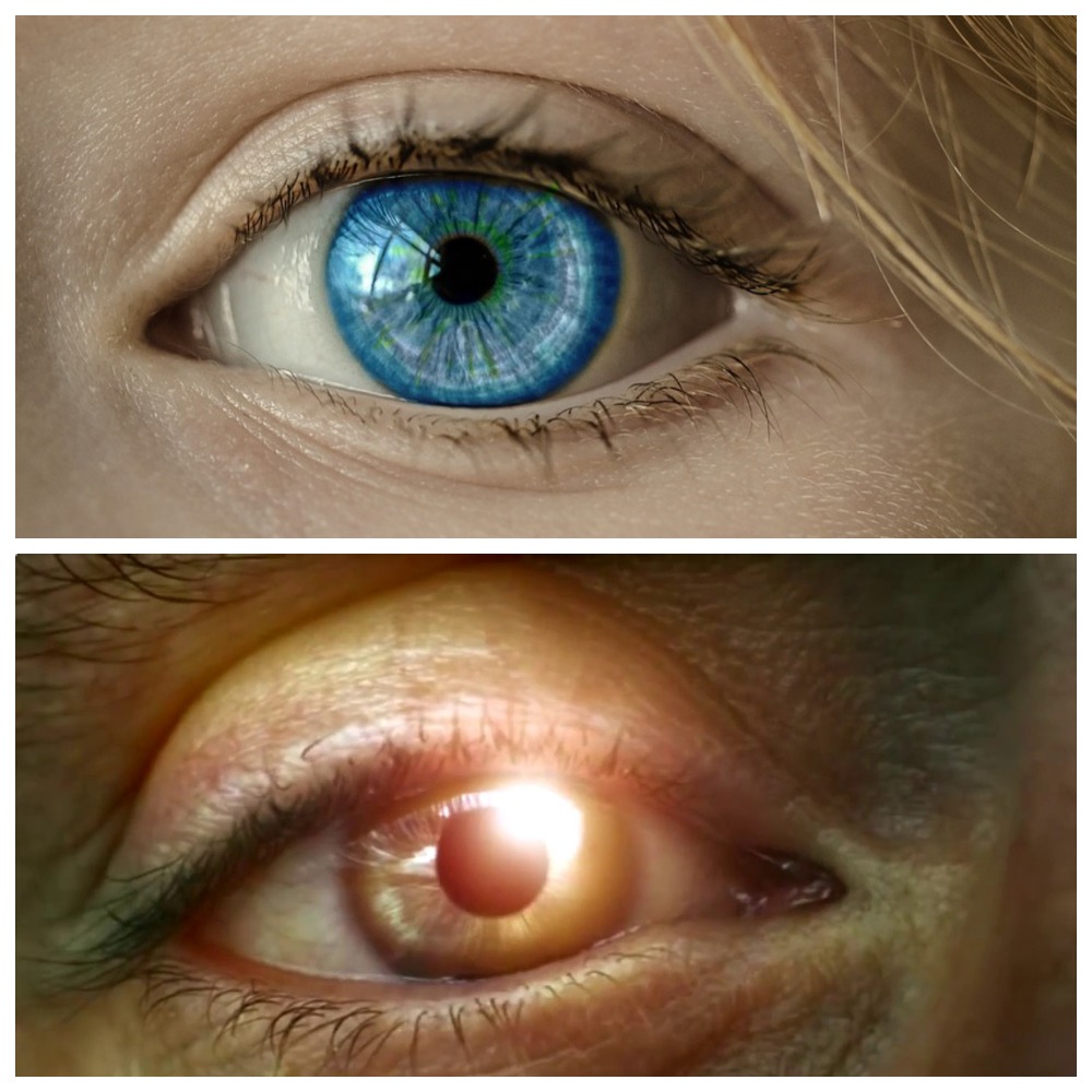 Аккомодация - важная способность глаза