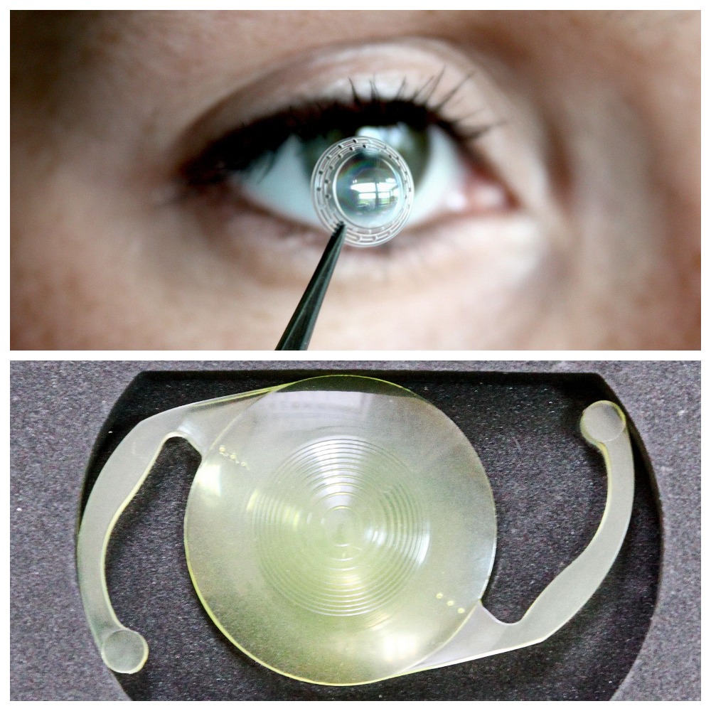 Разновидности и срок службы искусственных хрусталиков глаза